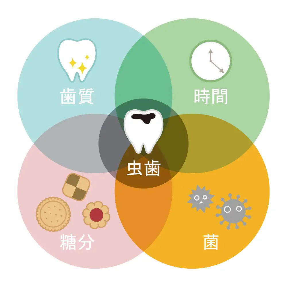 虫歯の原因（歯質・時間・糖分・菌）を示す図解